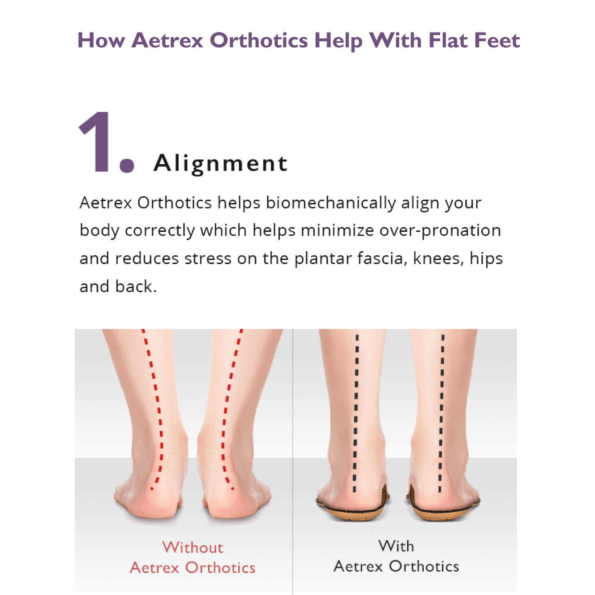Aetrex | Women's Orthotics L625W (Flat/Low Arch) with Metatarsal Support